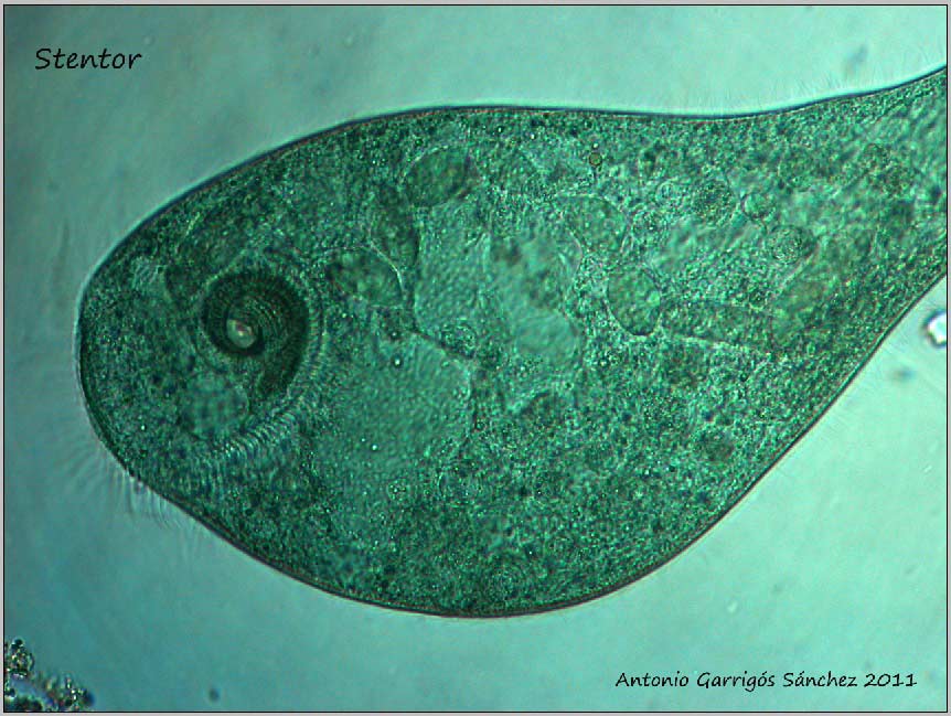 Stentor sp.